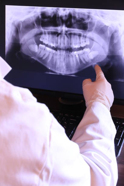 Best Emergency Treatment for Toothache in Severance, CO