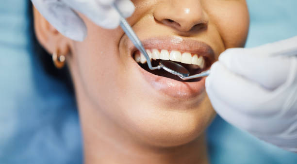 Best Pediatric Emergency Dentist in Severance, CO